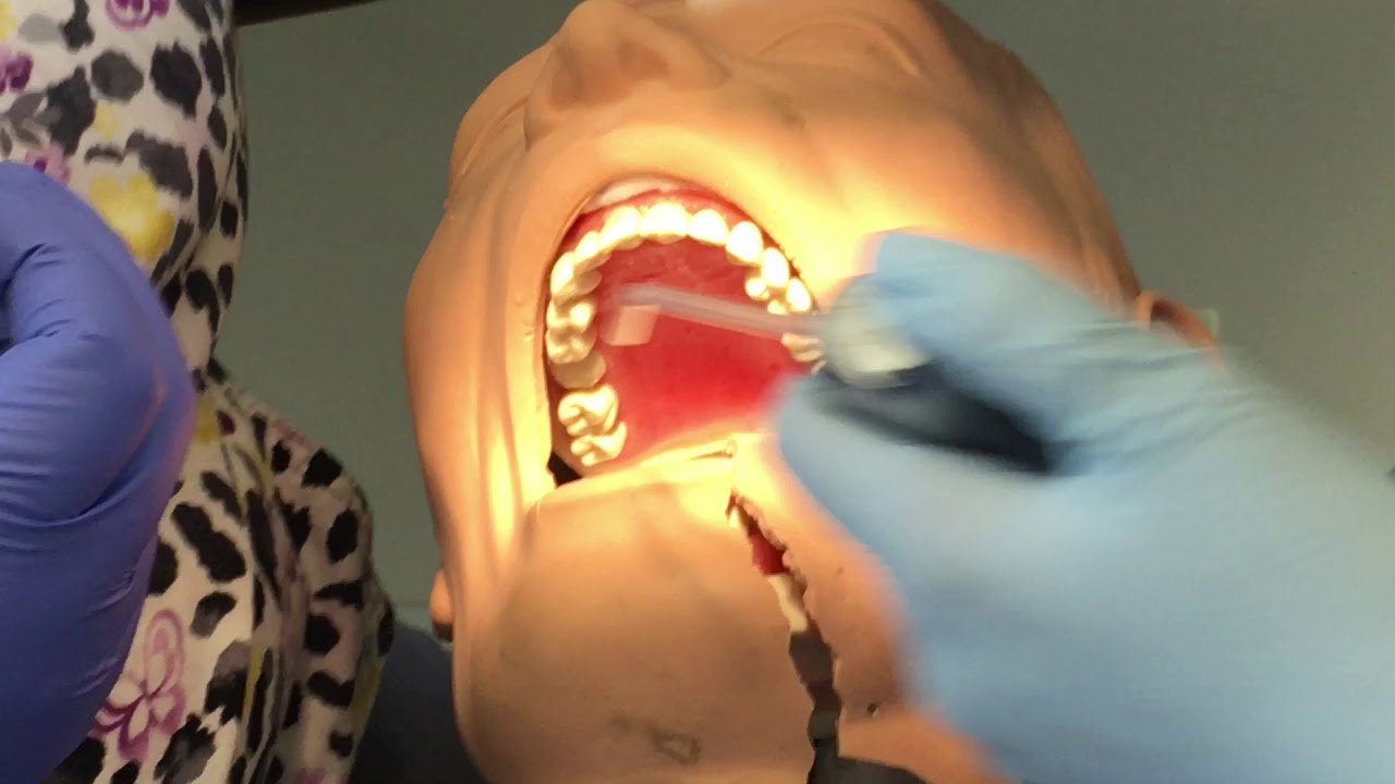 Assisting with a composite filling YouTube