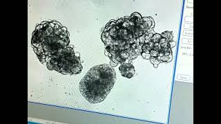 Emergence Of Ipsc Colonies
