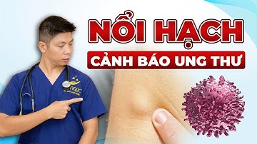 4 Dấu Hiệu Nổi Hạch Cảnh Báo Tình Trạng Ung Thư Cần Lưu Ý | Dr Ngọc