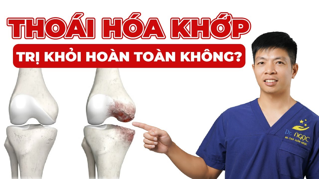 Thoái Hóa Khớp Có Điều Trị Khỏi Hoàn Toàn Được Không? | Dr Ngọc
