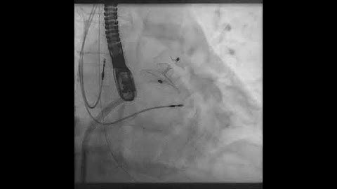 Volume rendering and embedded geometric shapes