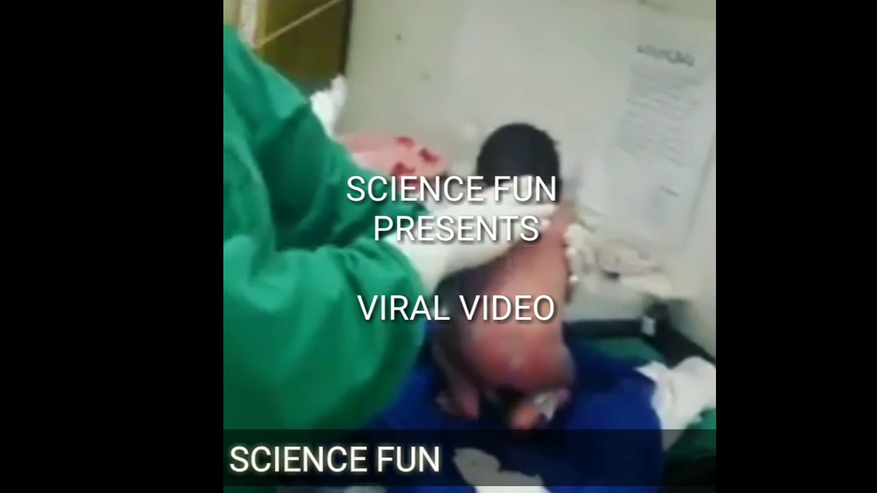 baby walking after birth viral video