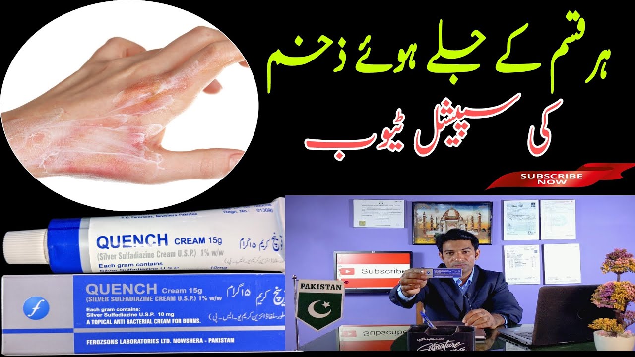 Burning Treatment jale howe zakham ka ilaj Quench cream Urdu Hindi