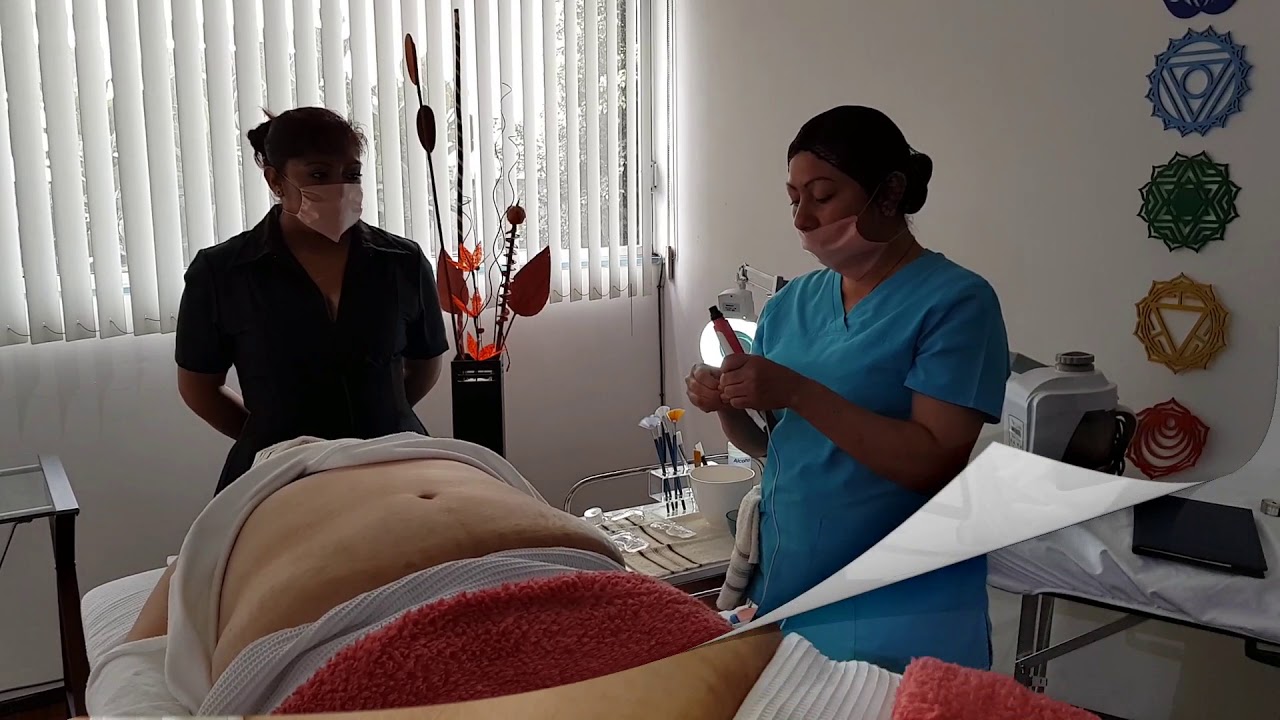 camera iphone 8 plus apk Micropulsion!