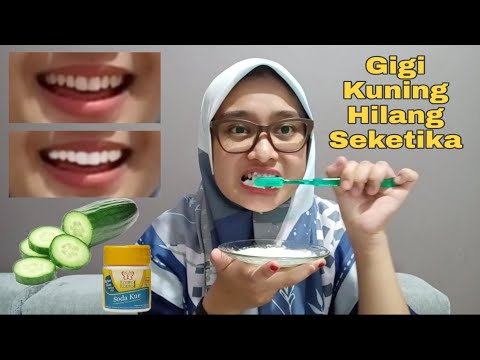 Video: Cara Membersihkan Gigi Palsu Dengan Cuka: 12 Langkah (dengan Gambar)