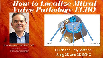 How to Localize Mitral Valve Pathology on 2D and 3D ECHO-A Quick and Easy Guide!