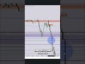 Midline as Resistance: Target Setting & Execution #shorts