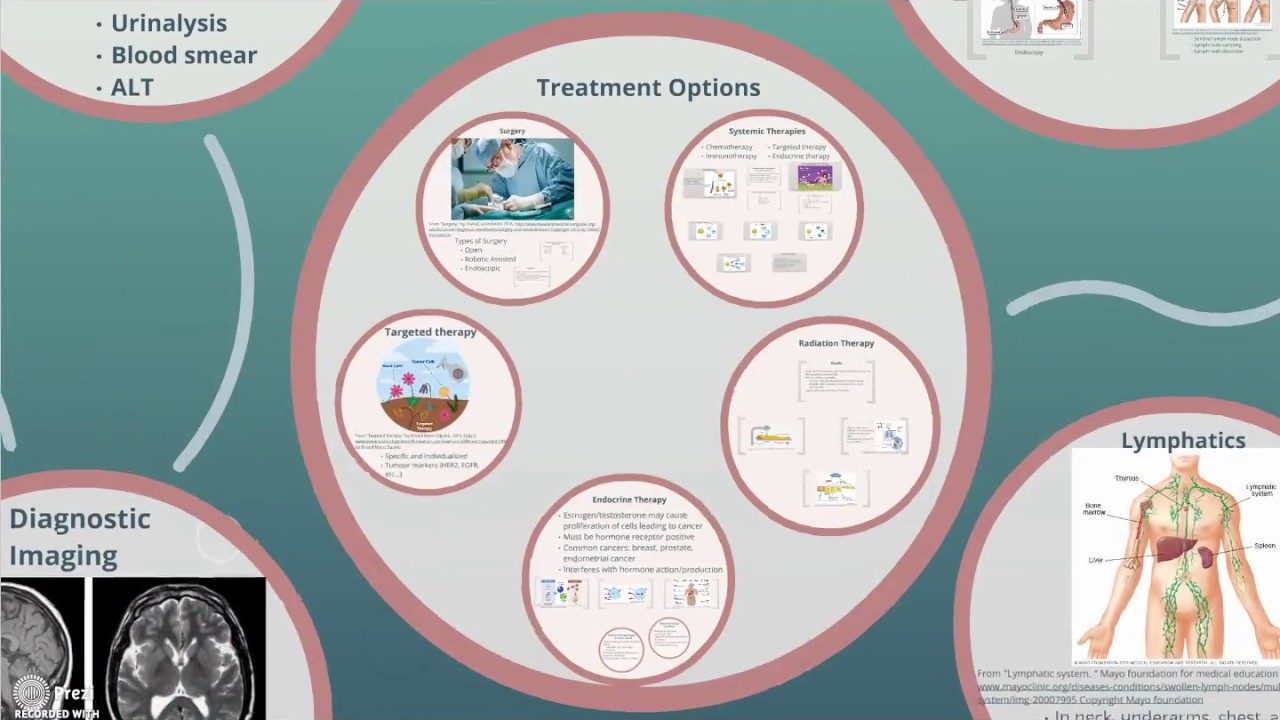 Cancer Mind Map