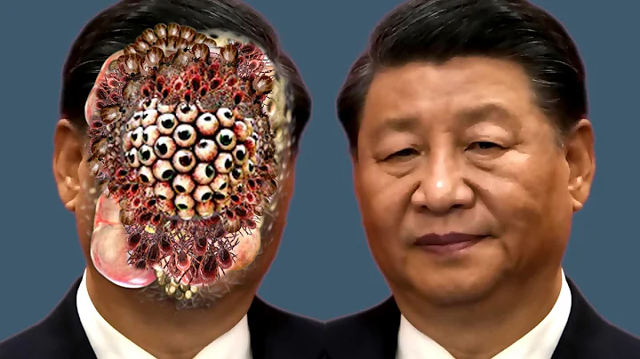 ASMR Removing Ticks and Maggots insects from xi Jinping Face - Deep Cleaning ASMR Animation