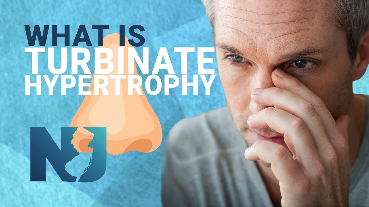 What Is Turbinate Hypertrophy We Nose Noses Youtube