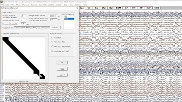 fMRI EEG Gradient Artifact Correction In BESA Research