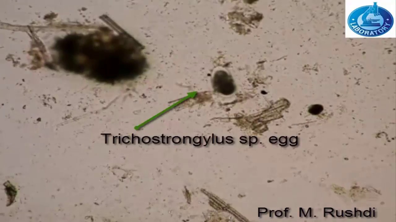 Simple and easy method for detection of eggs in feces YouTube