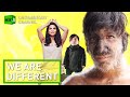 We Are Different. What it`s like to Be Special | RT Documentary
