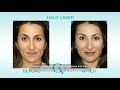 Under 45 Non Surgical Procedures by Dr Amir Karam