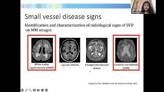 4 day International symposium Revolutionizing Medical Imaging with Computer Vision | 23rd Aug 2023