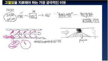 고혈압을 치료해야 하는 궁극적인 이유 - 동맥경화 이야기