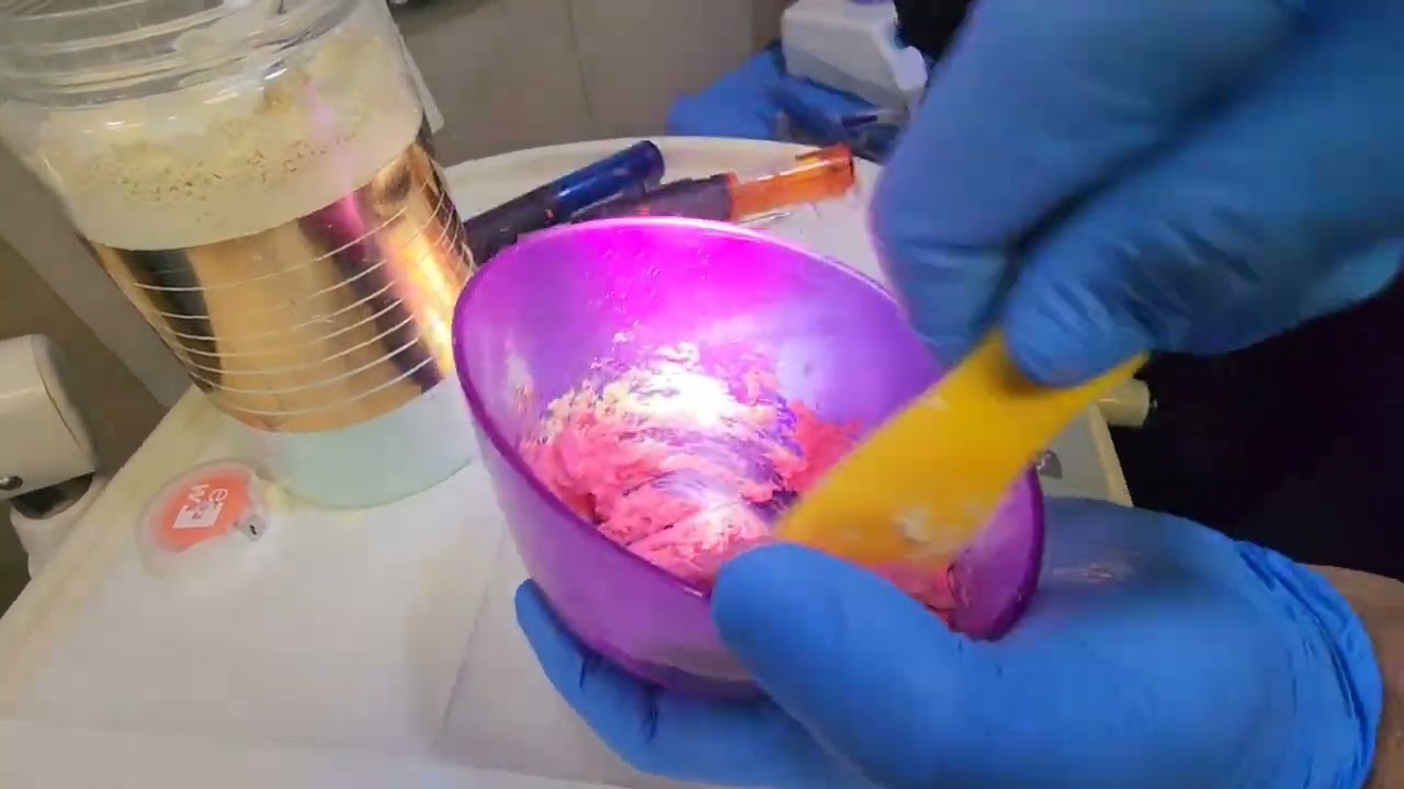 How to take an.                  impression to makea removable partial denture.