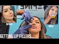 I GOT LIP FILLERS FOR THE FIRST TIME 2020 + Answering your questions!