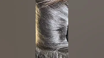 My Lice Comb Will Pick Out Even What You Can T See Rgvlicelady 