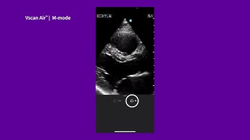 Vscan Air™ Tutorials | M-mode