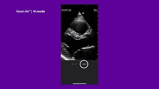 Vscan Air™ Tutorials | M-mode