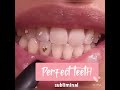 PERFECT teeth subliminal 🦷 (listen once)