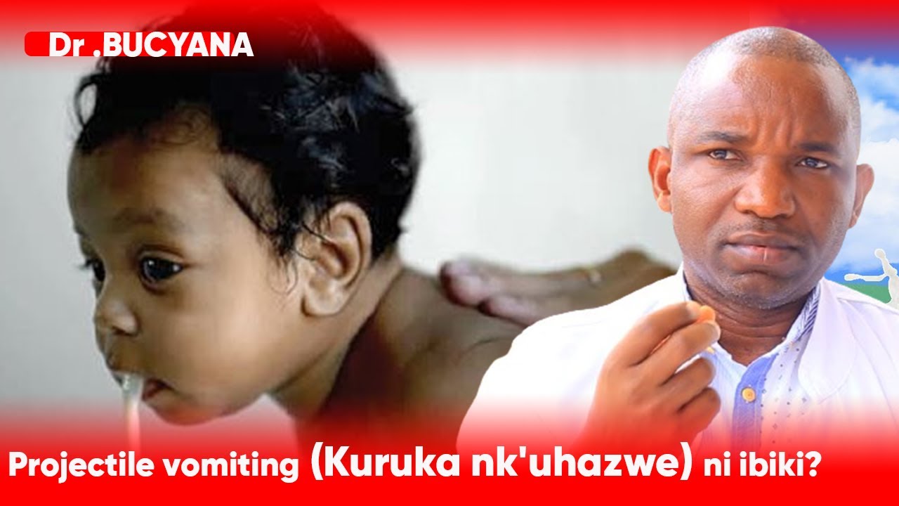Dr. BUCYANA:INDWARA YA PROJECTILE VOMITING (Kuruka nk'uhazwe) BYABA ARI IBIKI?