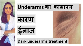 Dark underarms से काफ़ी लोग परेशान
रहते हैं। इस video में काले के
कारण और उसका सरल इलाज
बताया गया है। कारण/ causes : 0:38
क्या करना चाहिए/ do's and...