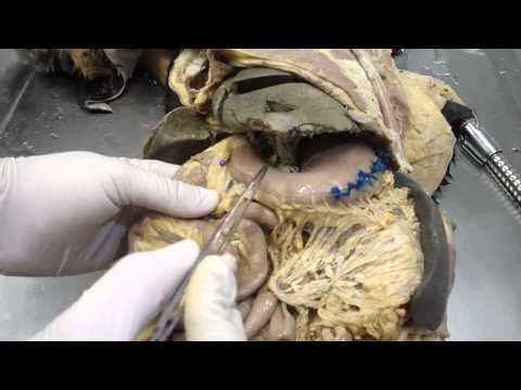Vídeo: Inflamação Da Cavidade Abdominal Em Cães - Cavidade Peritoneal Em Cães