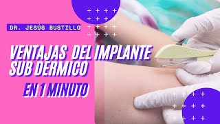 VENTAJAS del IMPLANTE subdermico (2021)