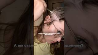 Остановить облысение - возможно? #маскаволос #hairtok #ростволос #haircare