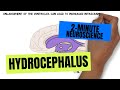 2-Minute Neuroscience: Hydrocephalus