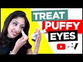 How To Treat Puffy Eyes | Dr. Vanita Rattan | Skin of colour | Asian/ Black skin | under eye bags