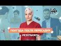 6 месяцев после пересадки волос. Каких результатов ожидать?