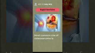 NEET PG Exam preparation #medicalentranceexam #anatomy #bones #orthopedicshortcase #neetpg #science