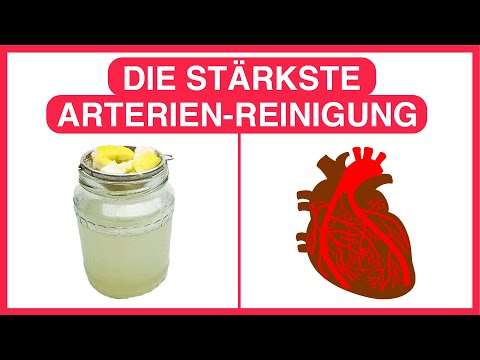 Dieses erstaunliche Getränk reinigt deine Arterien gründlich in kurzer Zeit [mit Rezept]