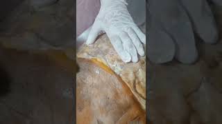 Anterior thoracic wall - Part 1 #thoraxanatomy #dissection #anatomy #anatomyforstudents #medico