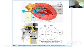 :    .   HRS/EHRA