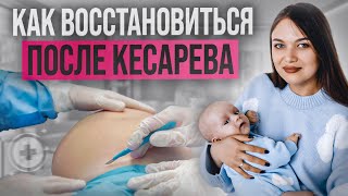 Как Восстановиться После Кесарева Сечения. Советы По Восстановлению После Кесарева Сечения