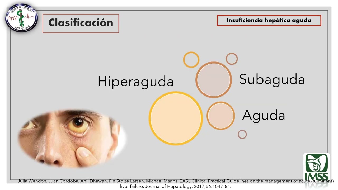 Insuficiencia Hepática Aguda