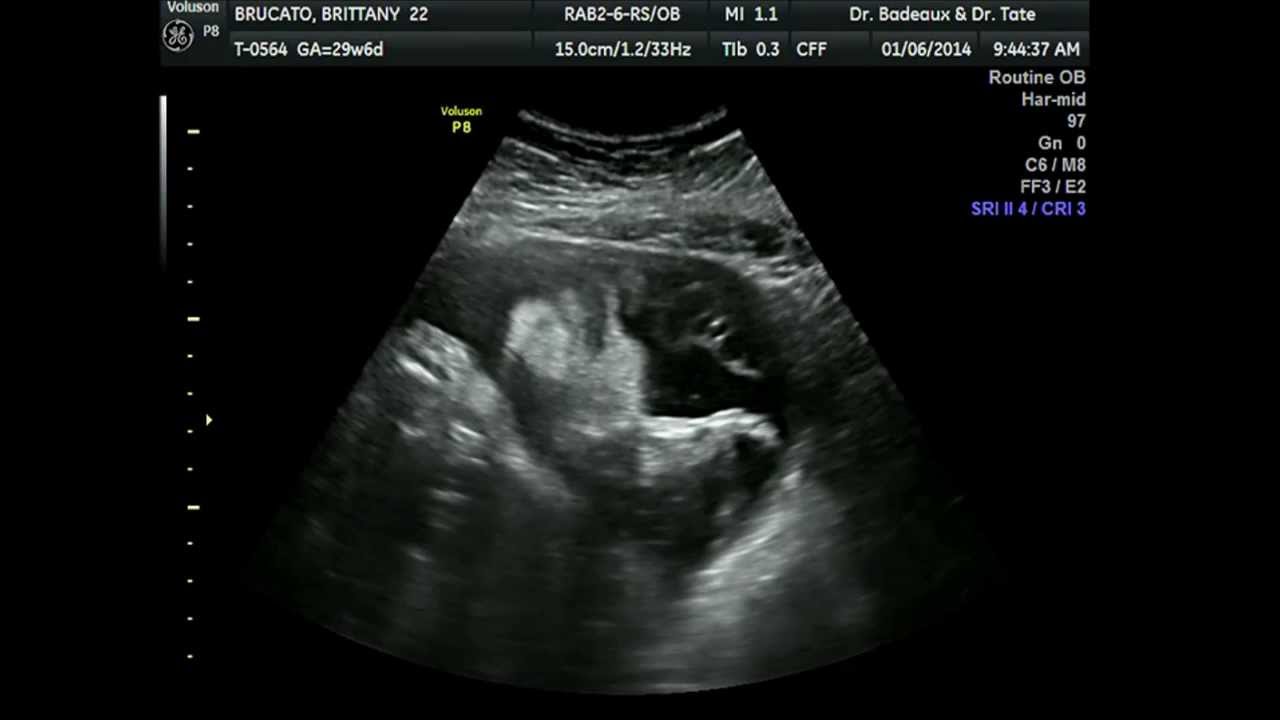Ultrasound 29 weeks 6 days with baby boy! - YouTube