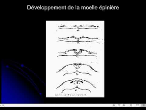 Video: Apakah spina bifida occulta memerlukan pengobatan?