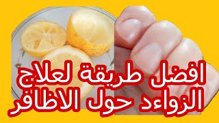 طريقة ازالة الجلد الميت حول الاظافر