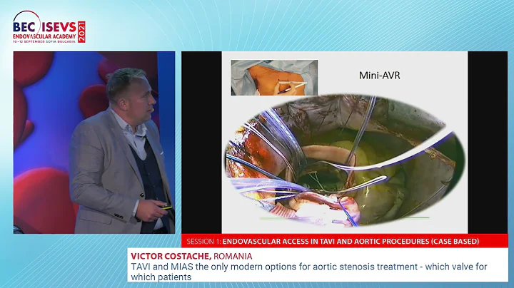 BEC 2021 | TAVI and MIAS the only modern options for aortic stenosis treatment | Victor Costache