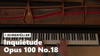 "Inquiétude" 25 Progressive Studies Op. 100 No. 18 by F. Burgmüller