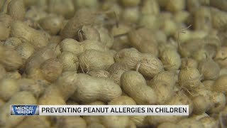Study shows promise in preventing peanut allergies