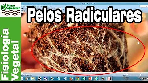 ¿Dónde están los pelos radicales?