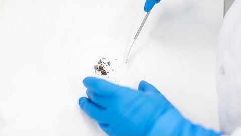 Accurate Kidney Stone Analysis