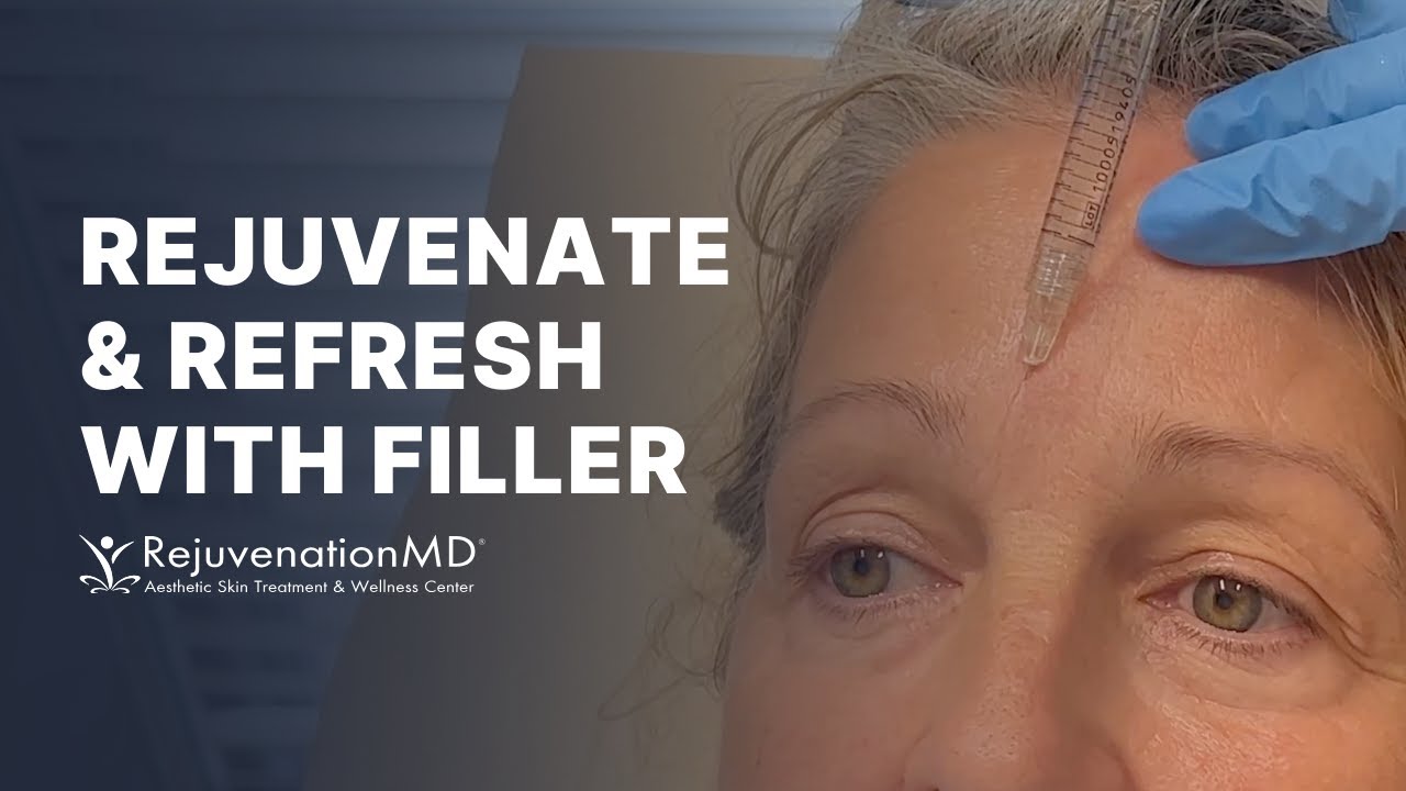 How To Prevent Frown Lines Around Mouth