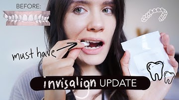 FIRST WEEK of INVISALIGN experience - Does it hurt? Cleaning trays + Necessities!